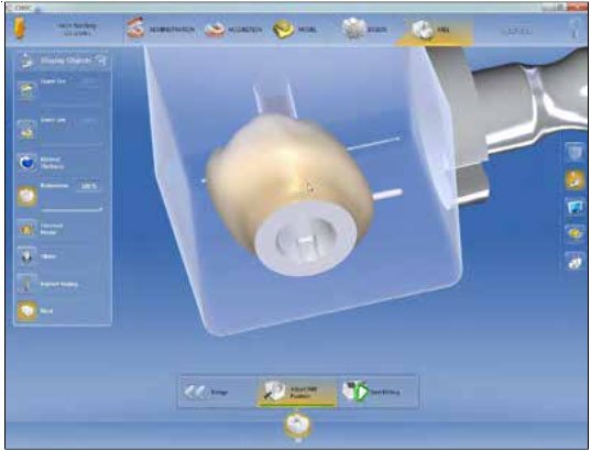 cerec scanpost options