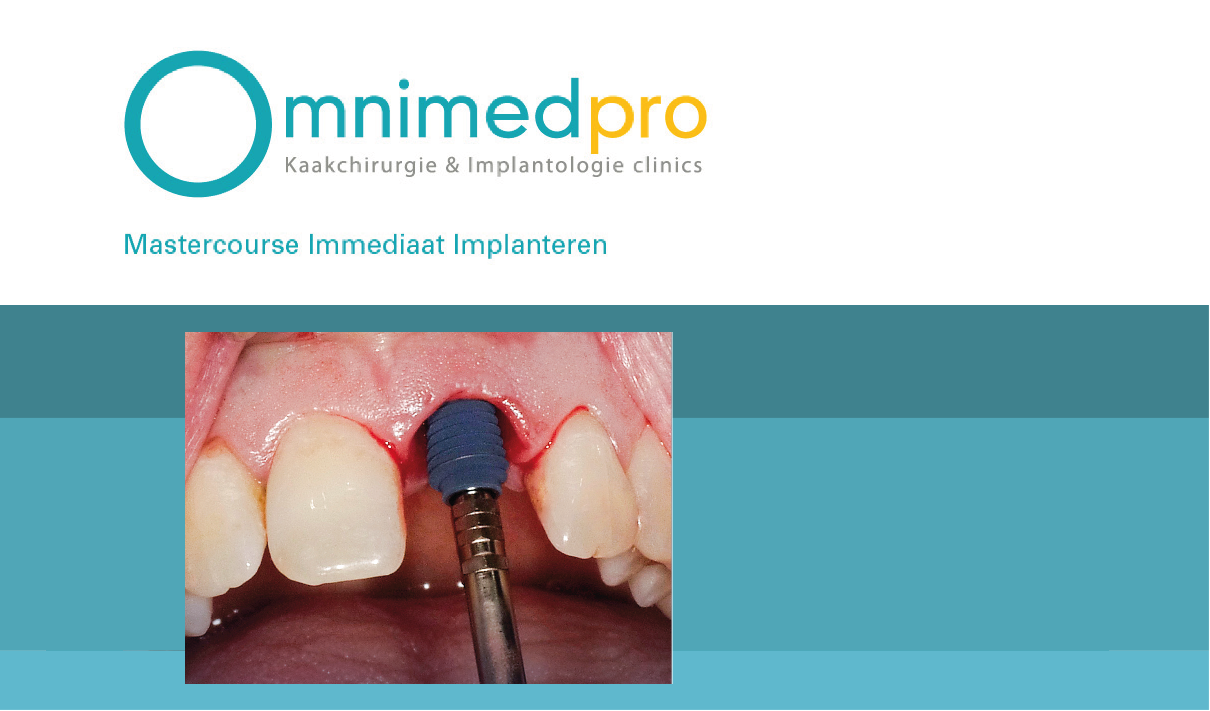 MegaGen Implant Academy