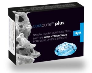 Botiss botmaterialen