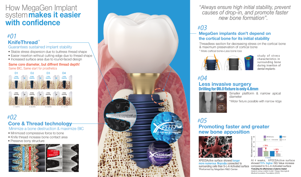 how-megagen-implant-system-makes-it-easier-with-confidende3