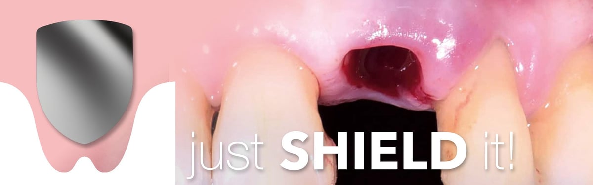 botiss novamag shield