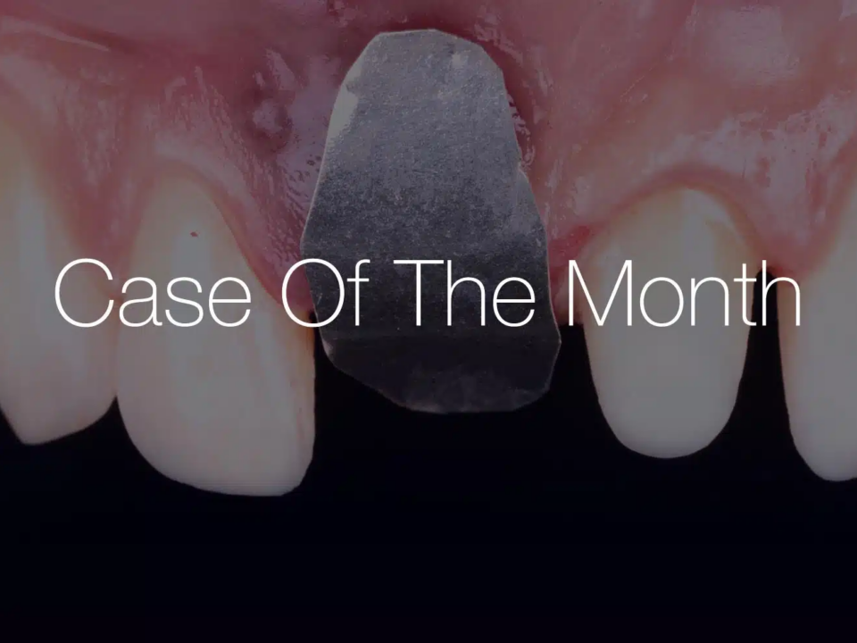 botiss case of the month